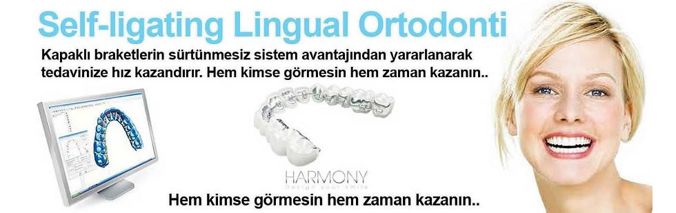 self-ligating-lingual-ortodonti